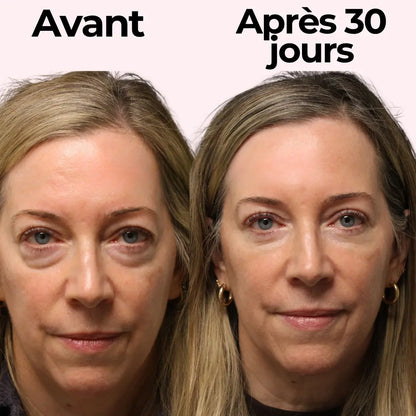 ZeroTrace™ – Lunettes 2 en 1 Anti-Cernes